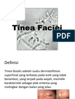 Tinea Faciei