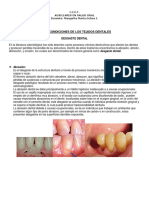 Desgastes Dentales PDF