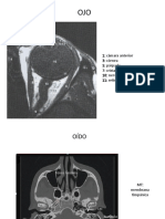 4 - Imágenes Ojos-Oído T3