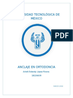 Anclaje en Ortodoncia