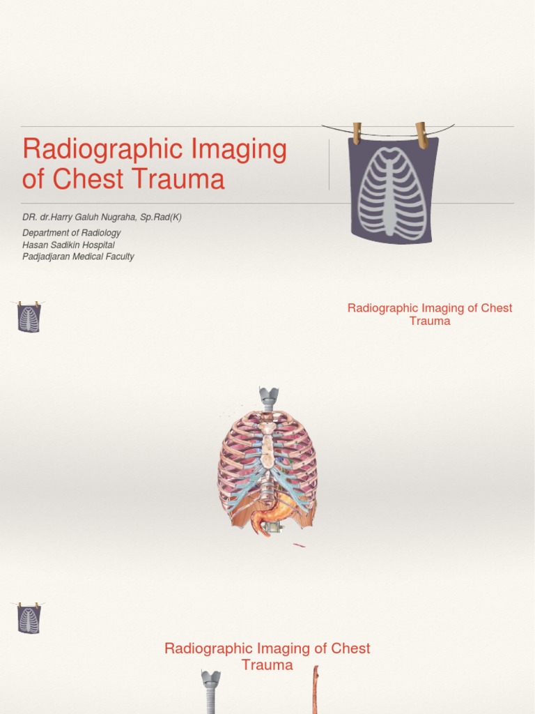 Chest Trauma Radiographic Imaging Guide | PDF