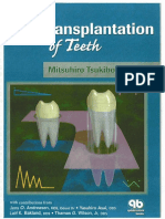 Autotransplantation of Teeth PDF