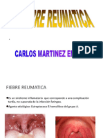 2. FIEBRE REUMATICA