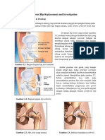 Total Hip Replacement and Investigation