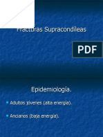 Fracturas Supracondíleas.ppt