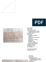 Tugas Ekg