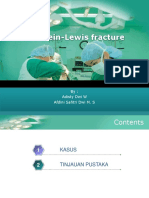 Holstein-Lewis fracture.pptx