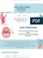 ABSES PERITONSIL