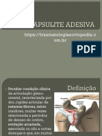 Capsulite Adesiva