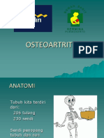 Osteoartritis