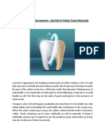 Dental Urgent Care Sacramento - Get Rid of Yellow Teeth Naturally