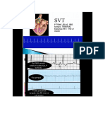 EKG.docx