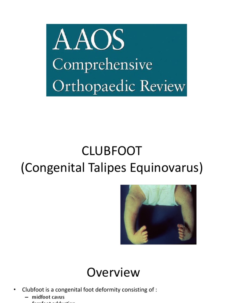 Clubfoot: Pathoanatomy and Treatment | PDF | Musculoskeletal System ...