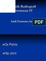 TRD Pelvis IV