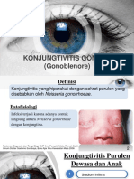 Eye Scanning Ophthalmology PowerPoint Template