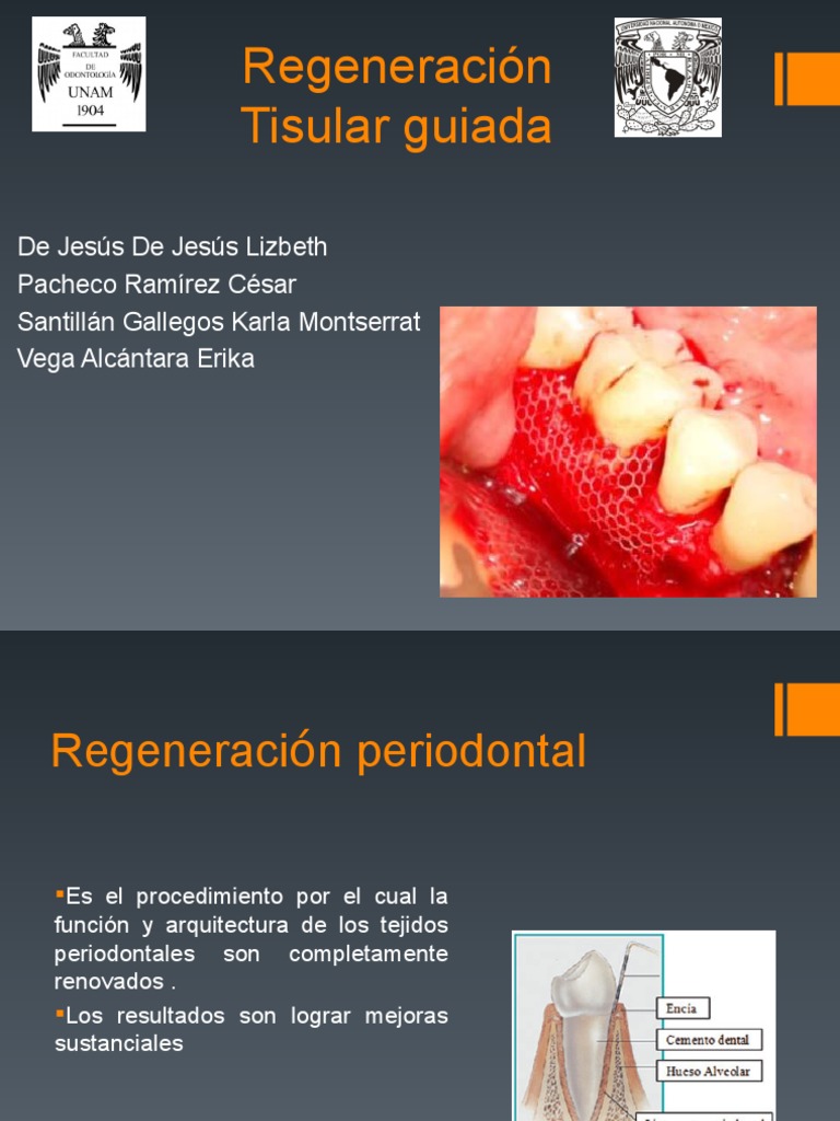 regeneracion-tisular-guiada-regeneraci-n-biolog-a-tejido-biolog-a