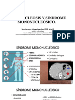 Mononucleosis y Sindrome Mononucleósico