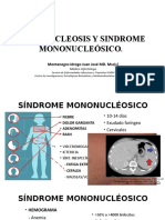 Mononucleosis y Sindrome Mononucleósico