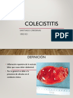 Colecistitis y Colelitiasis