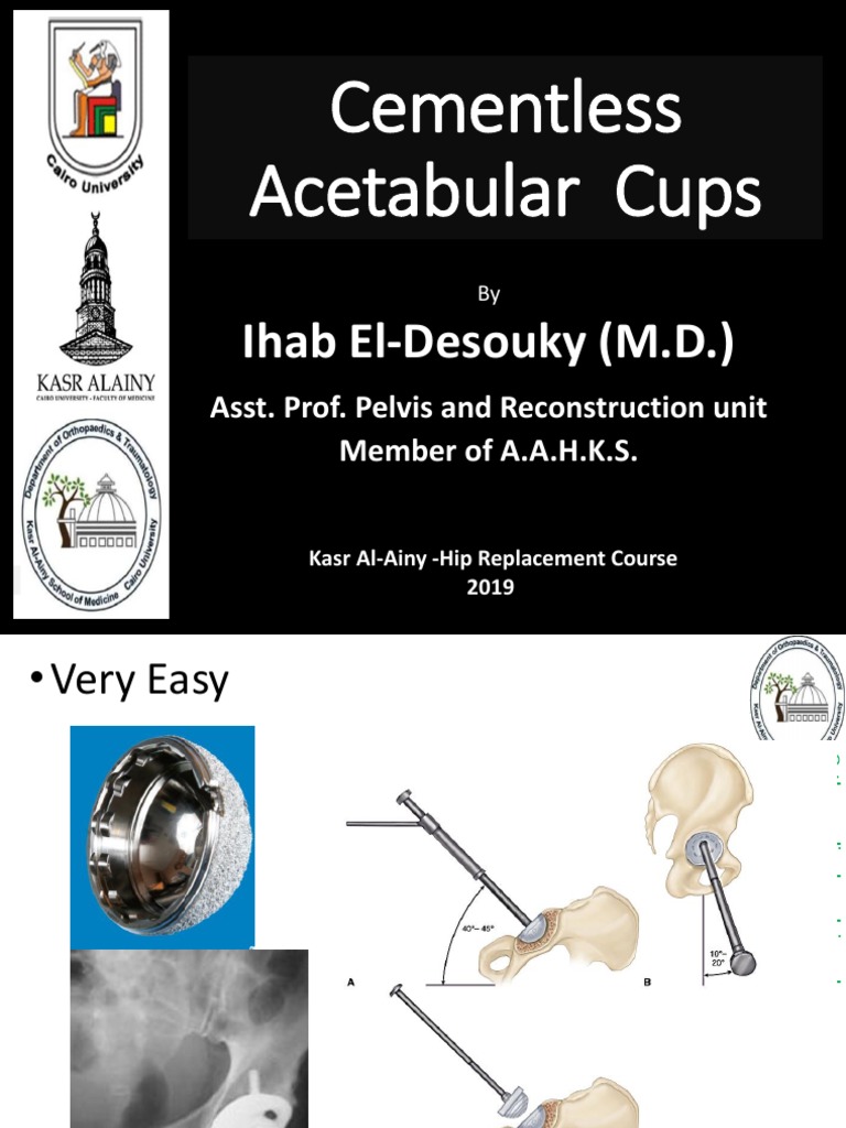 Evolution of Cementless Acetabular Cups | PDF | Technology & Engineering