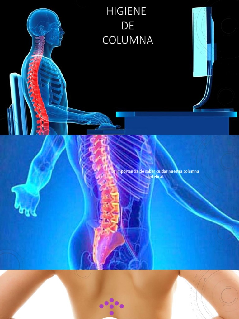 Higiene de Columna | PDF