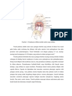 2.1.1 Abses Peri Tonsil