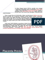 48 Placenta Previa 2.pptx