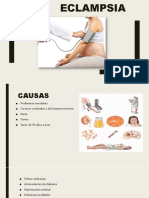 Eclampsia