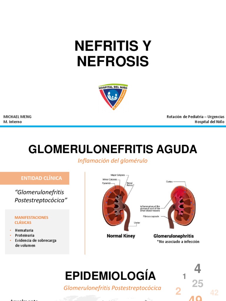 Nefrosis y Nefritis | PDF | Edema | Medicina Interna