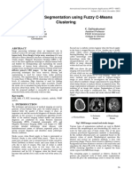 Brain Stroke Segmentation Using Fuzzy C-Means Clustering