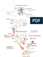 ACUTE RENAL FAILURE.docx