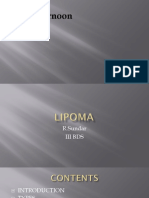 LIPOMA