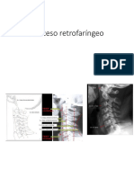 Absceso Retrofaríngeo (Autoguardado)