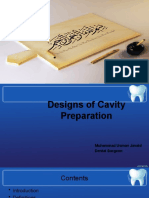 Designs of Cavity Preparation
