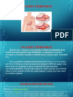 Ulcer perforat