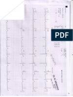 R_441941_zhw-2019-180303-ecg_other_report(1).pdf