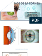 Trastornos de La Córnea
