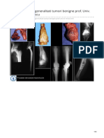 Tumorile Osoase Generalitati Tumori Benigne Prof Univ DR Mihai V Popescu