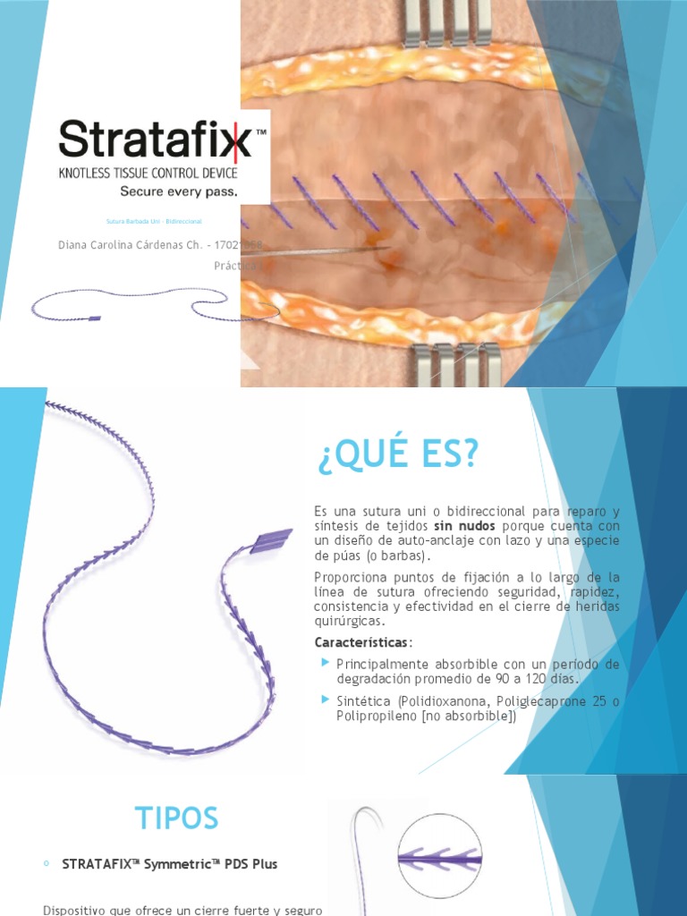 Stratafix Vs Quill , Performance Data Sheet – KPXMAW