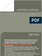 Aritmia Lethal