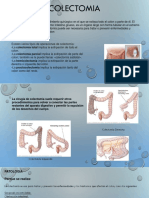 COLECTOMIA