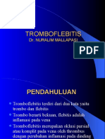 Tromboflebitis