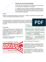 Anemia de Celulas Falcifolmes