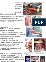 Tratamiento Quirurgico de Quemaduras de Espesor Completo