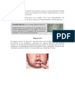 Candidiasis Bucal