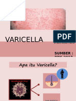 Varicella