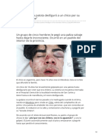 clarin.com-Mendoza Una patota desfiguró a un chico por su tonada chilena.pdf