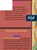 Ventricular Septal Defect