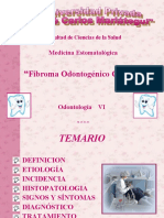 Fibroma Odontogénico Central