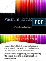 Vacuum Extraction: (Fetal Complications)